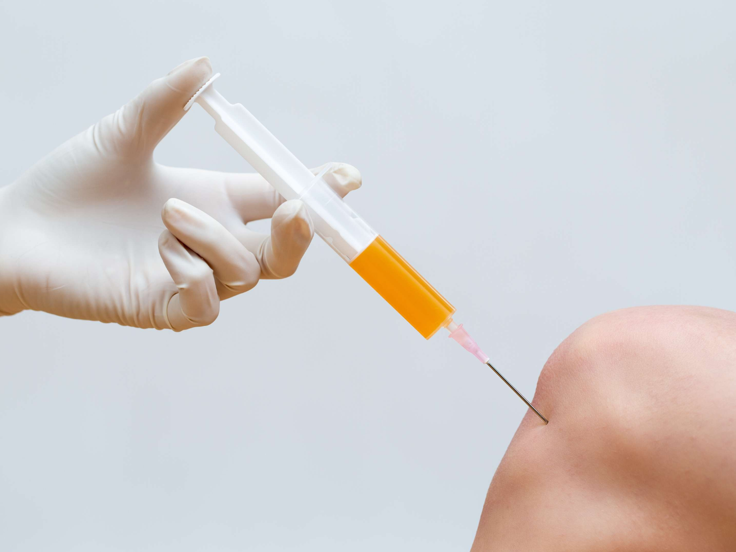 Platelet Rich Plasma (PRP) treatment at SageMED - autologous regenerative therapy for tissue repair