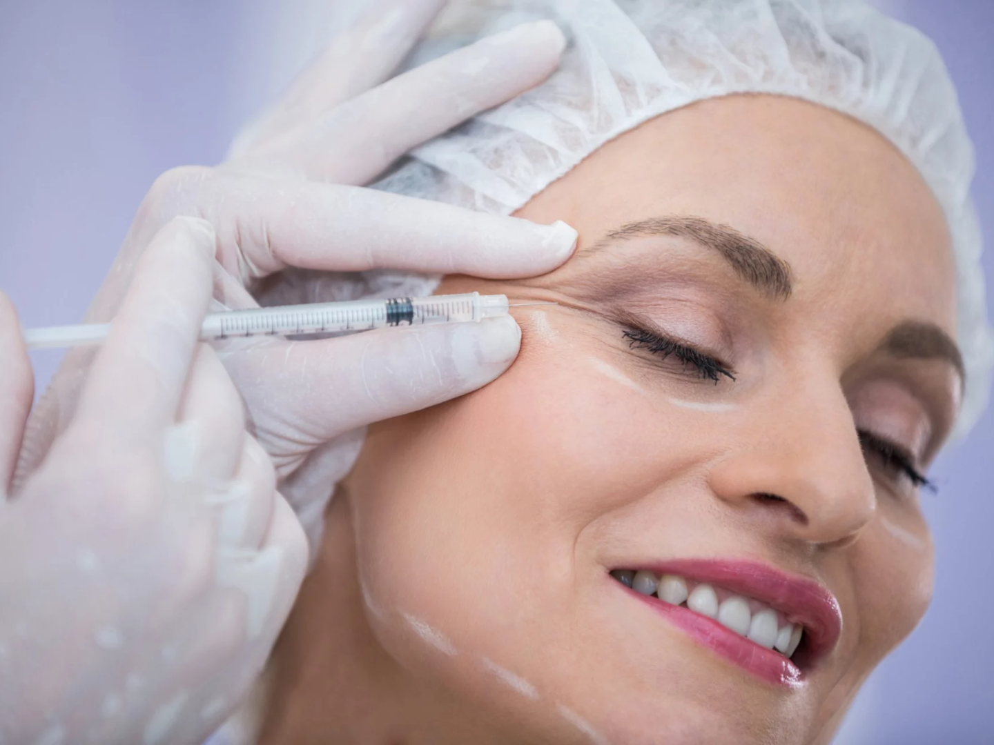 PRP Facelift treatment at SageMED Integrated Health