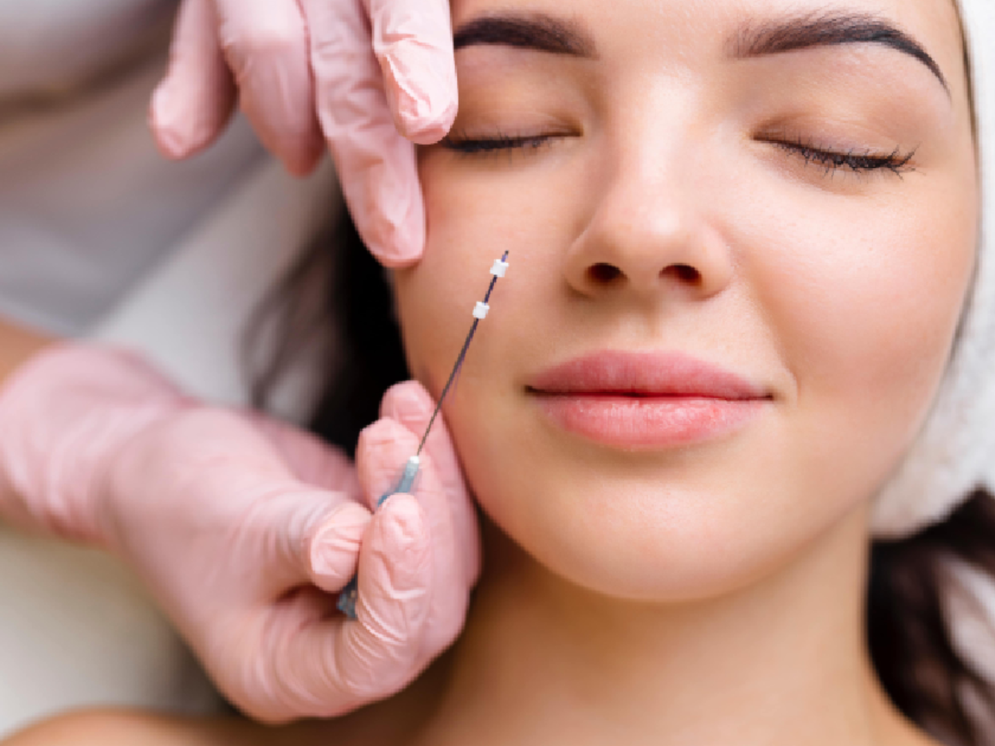 Clinician performing PDO thread lift injection in the cheek area for non-surgical facial lifting and skin tightening