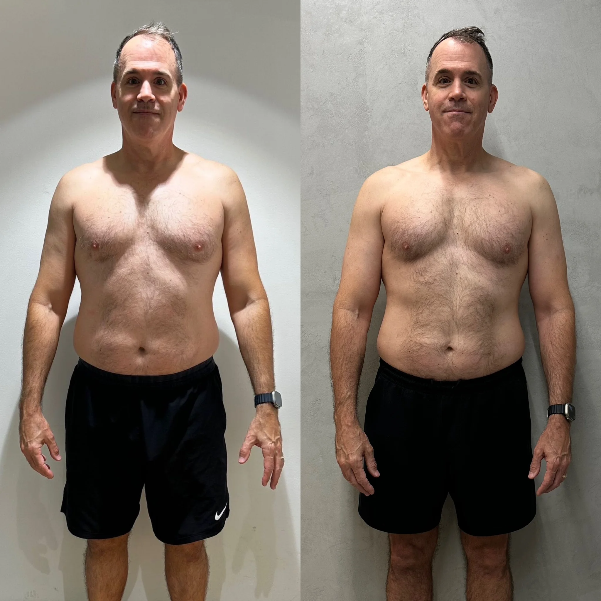 Charlie front — before and after