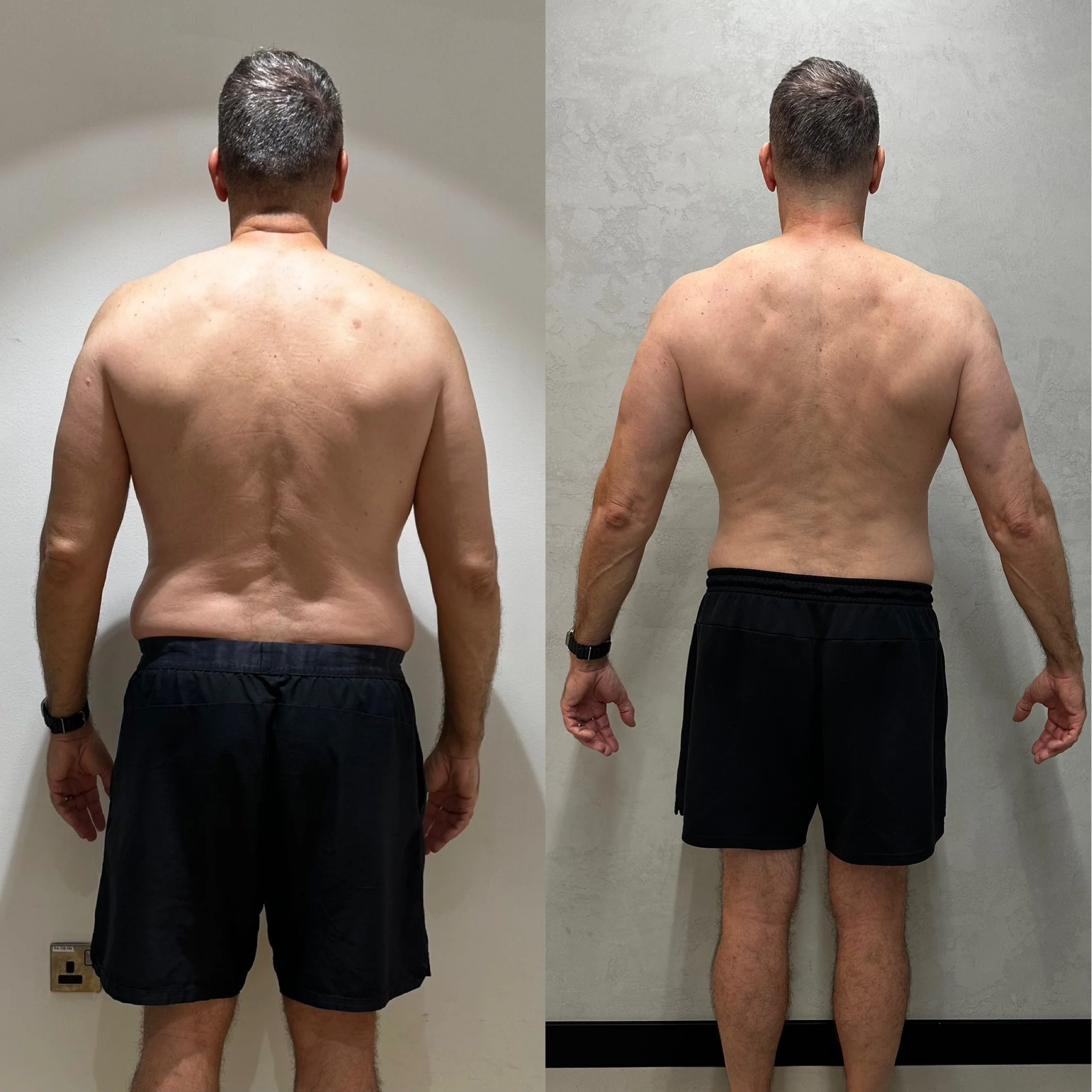 Charlie back transformation — before and after