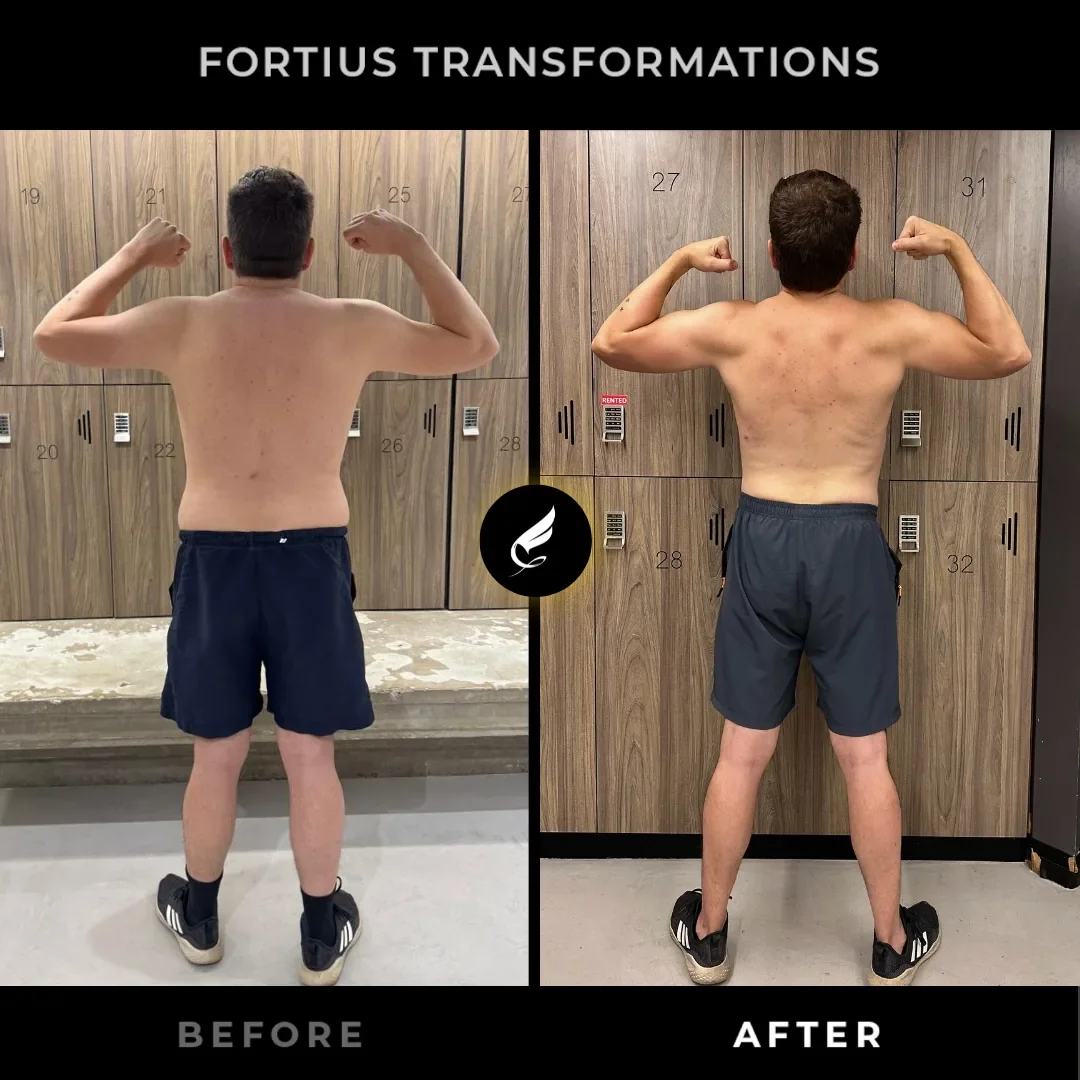 Phillipe — Back Before & After