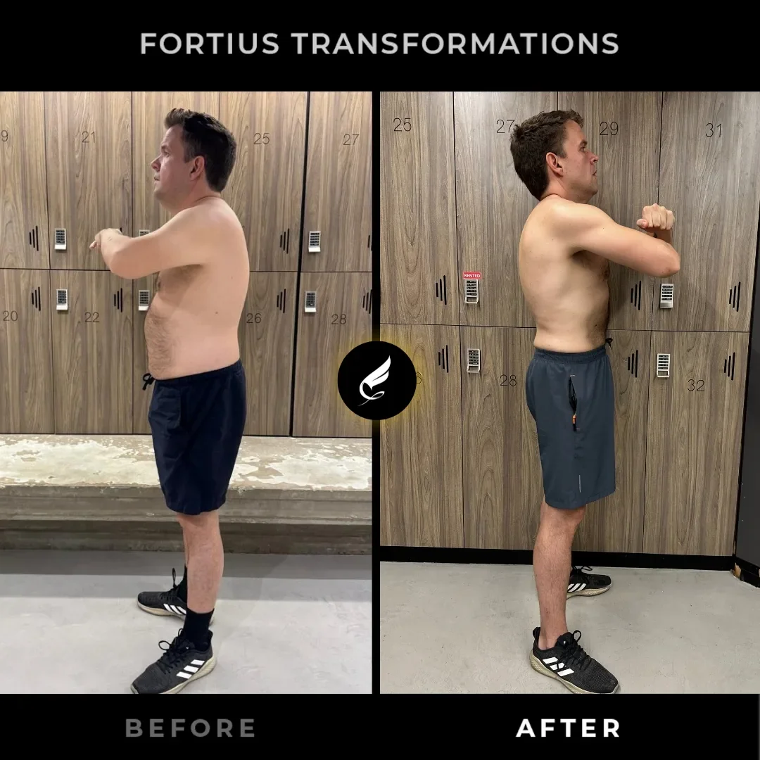 Phillipe — Side Before & After