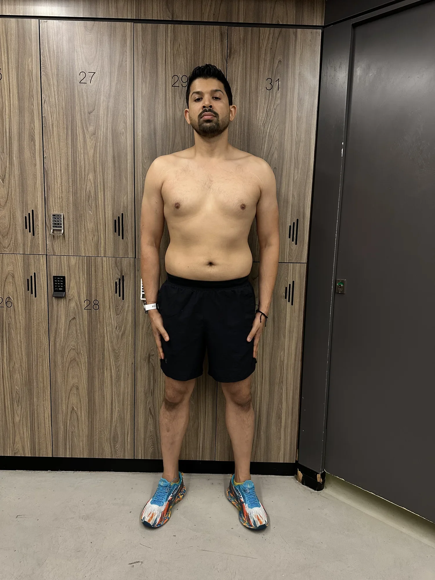 Rohan B. after — front view