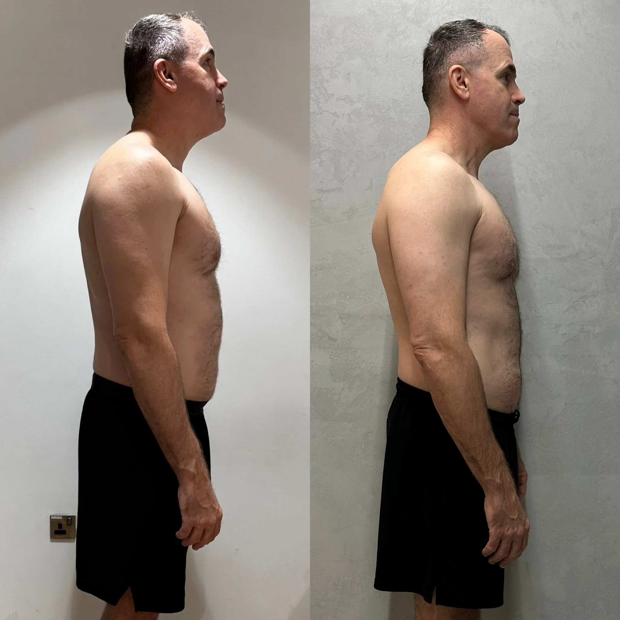 Charlie side profile — before and after