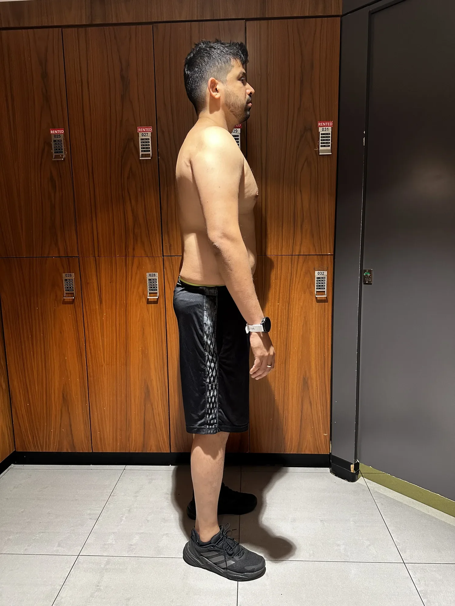 Rohan B. before — side view