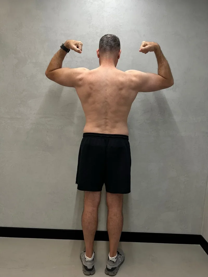 Charlie transformation Dubai