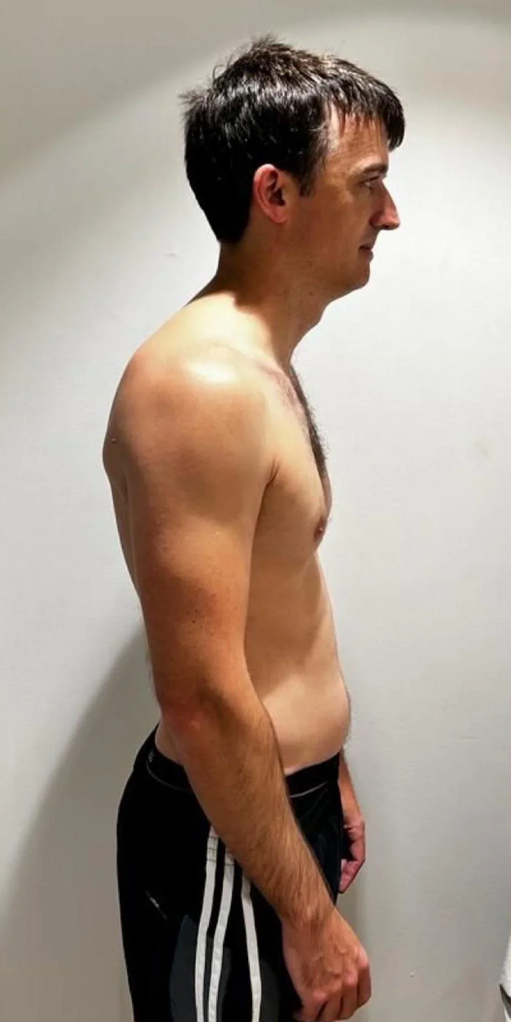 Nick side before transformation