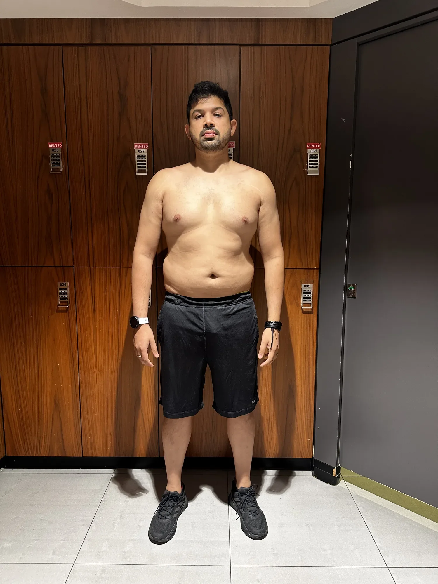 Rohan B. before — front view