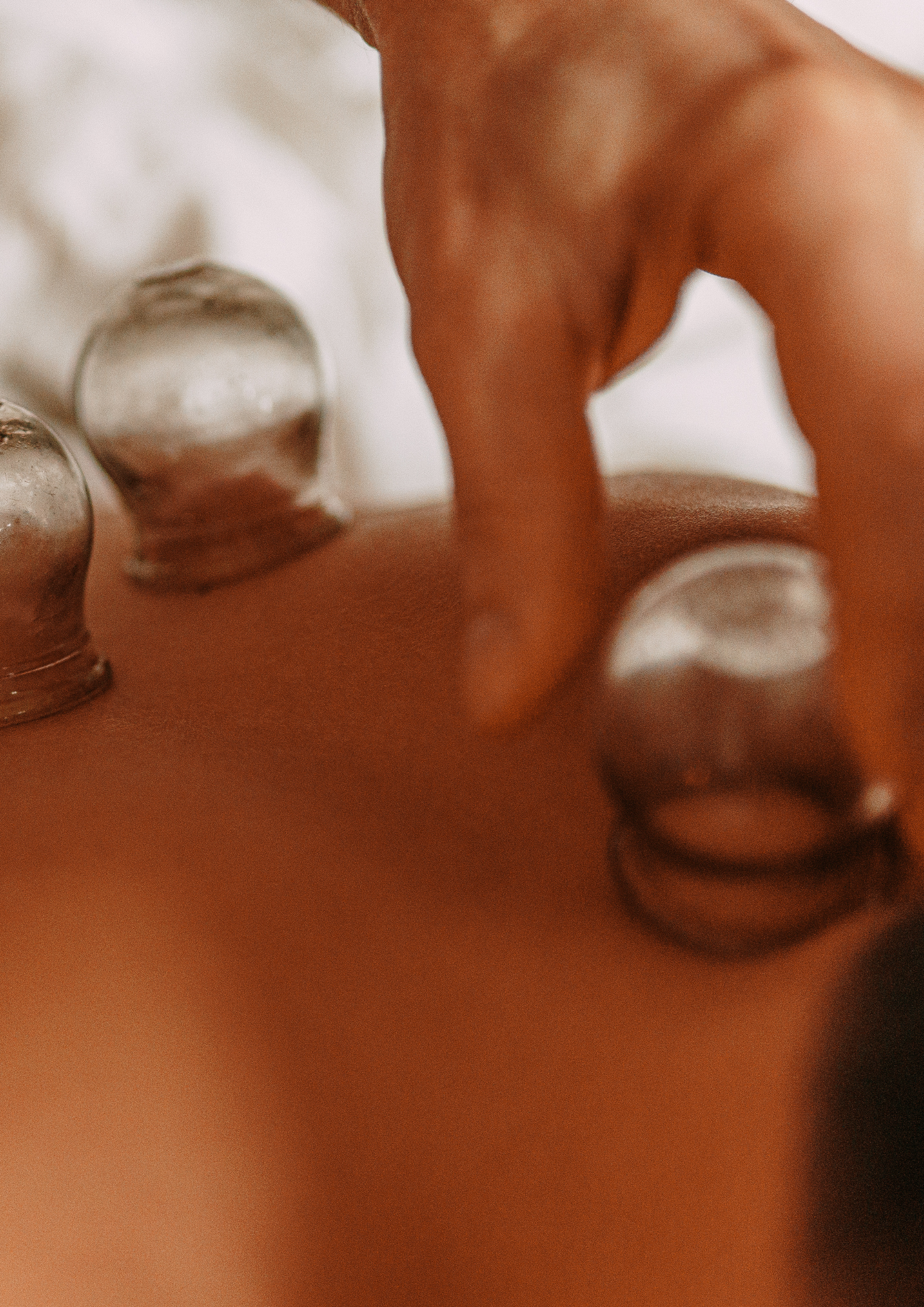 Cosmetic acupuncture Auckland — facial rejuvenation