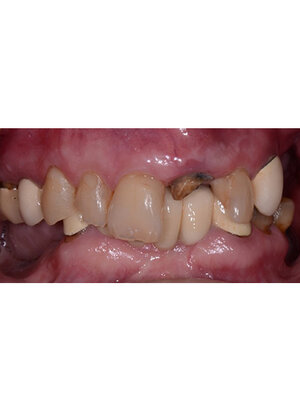Before Image