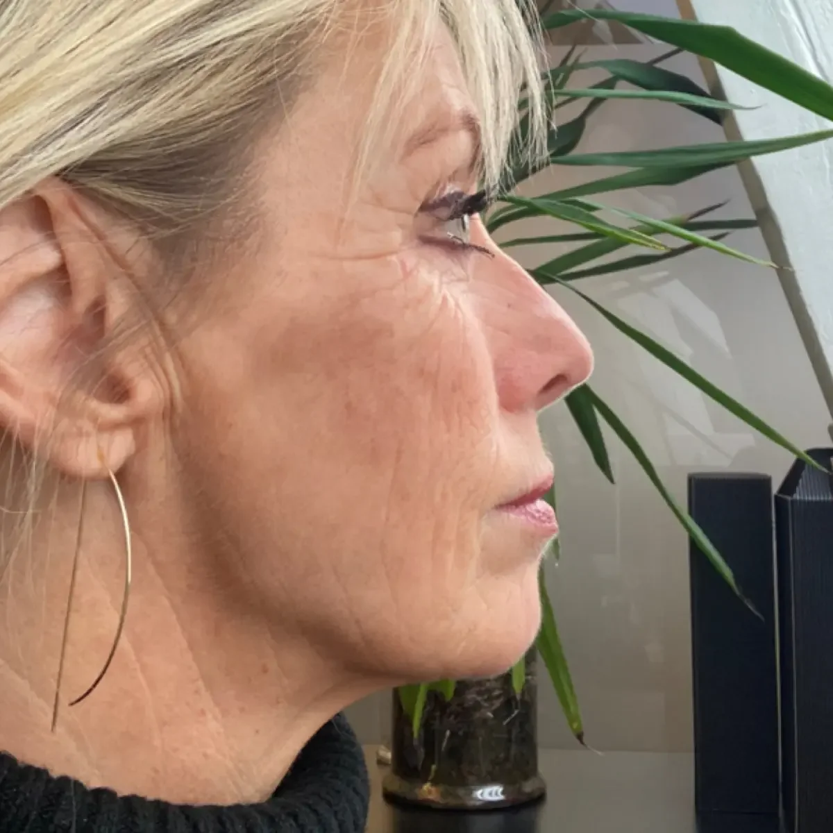 Efterbillede af deltager efter ansigtsyoga