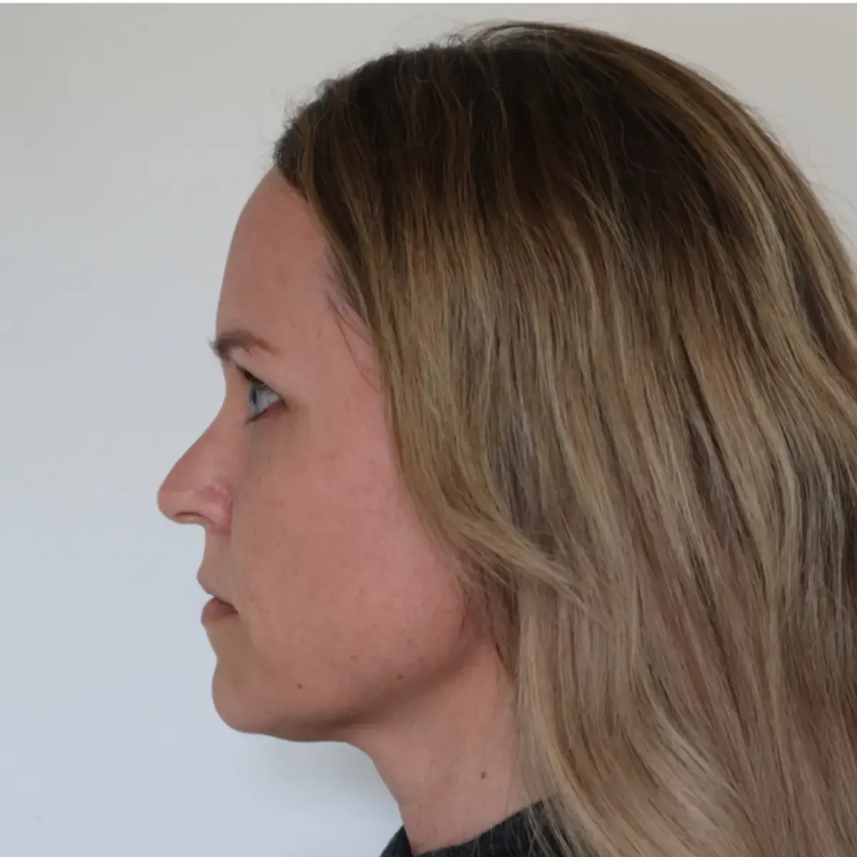Efterbillede af deltager efter ansigtsyoga