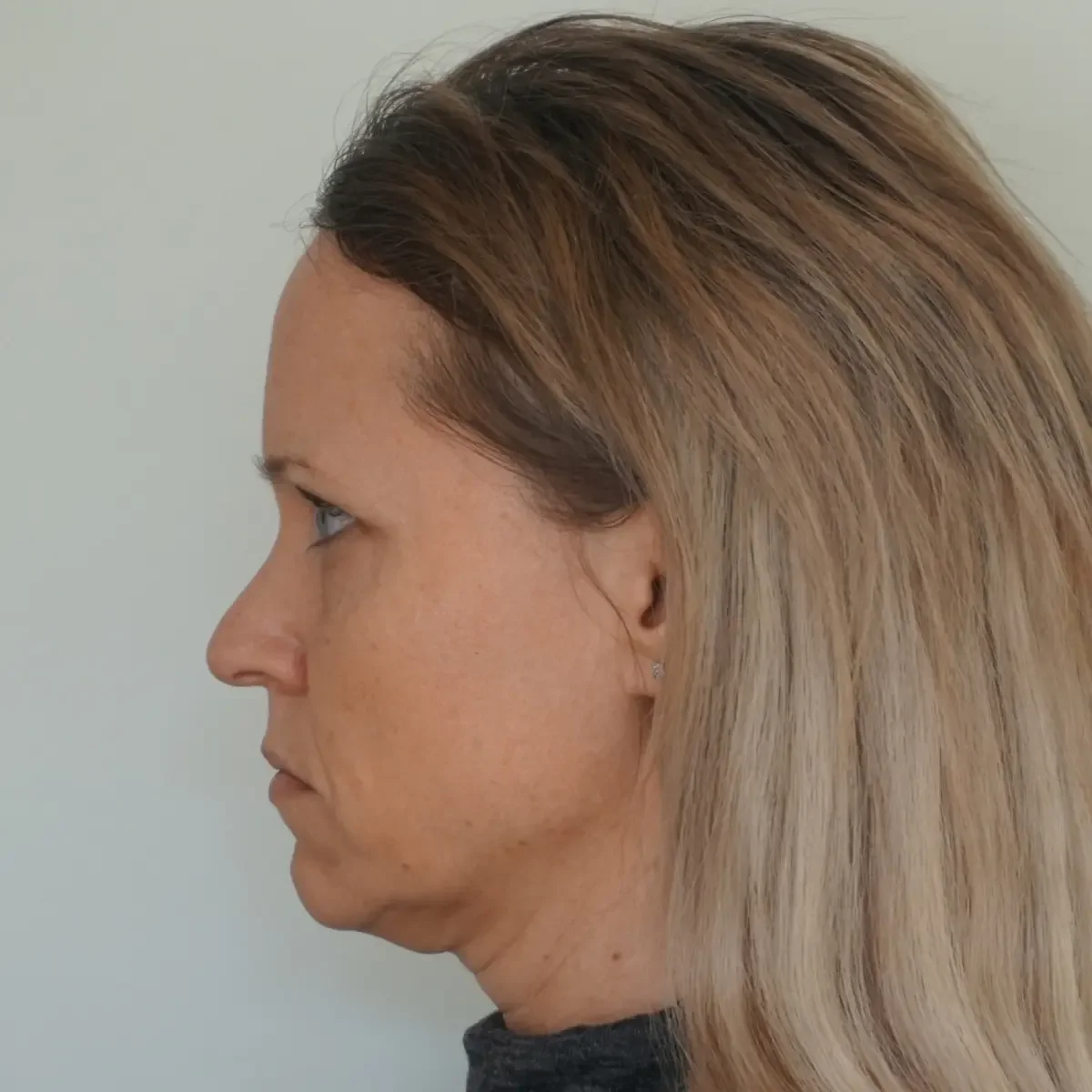 Førbillede af deltager inden ansigtsyoga