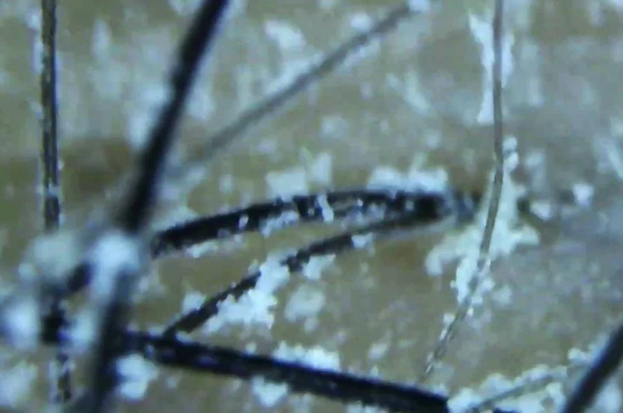 Scalp camera view after aerosol dry shampoo: white flakes clumped on the strands and the scalp