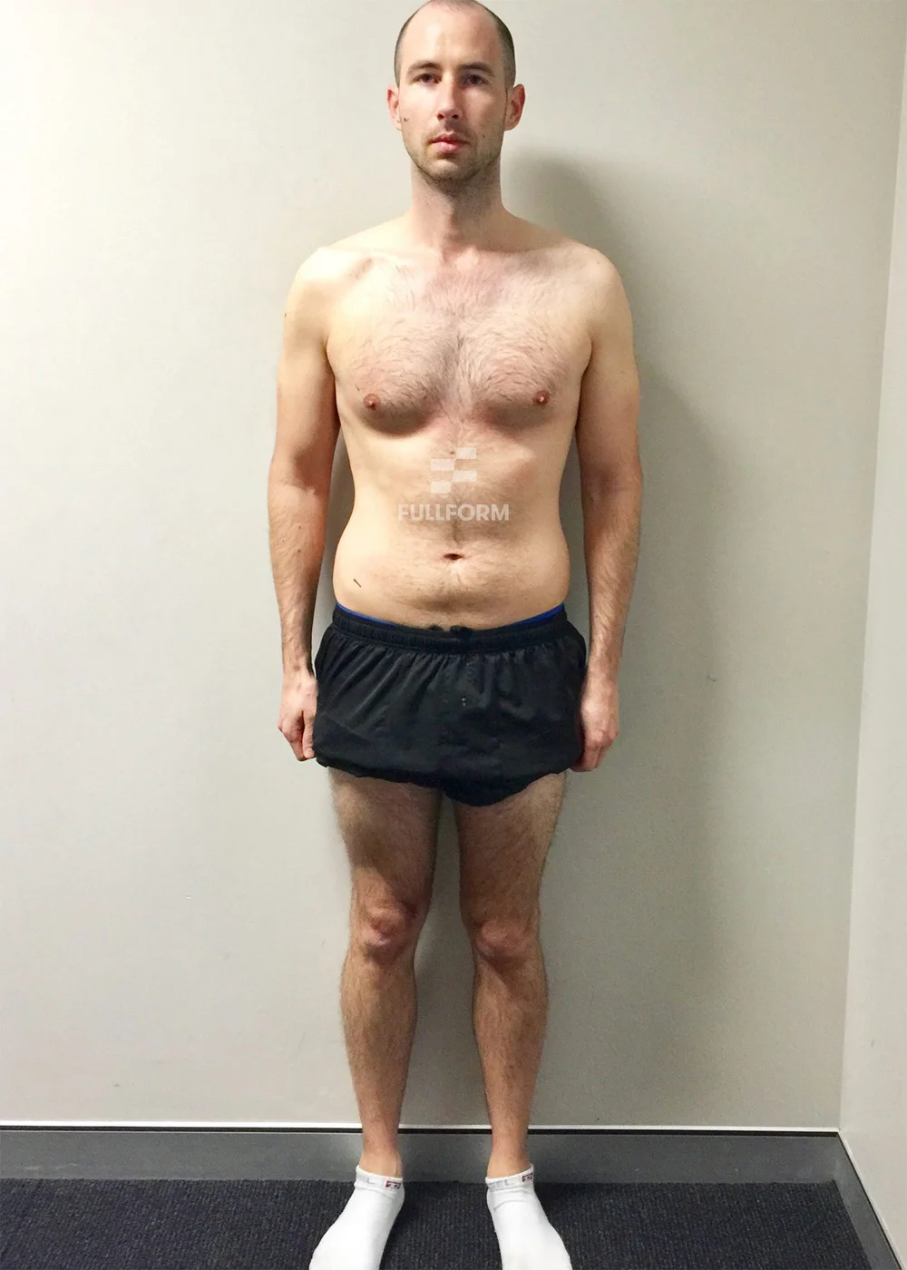 Robin before FullForm transformation in Sydney