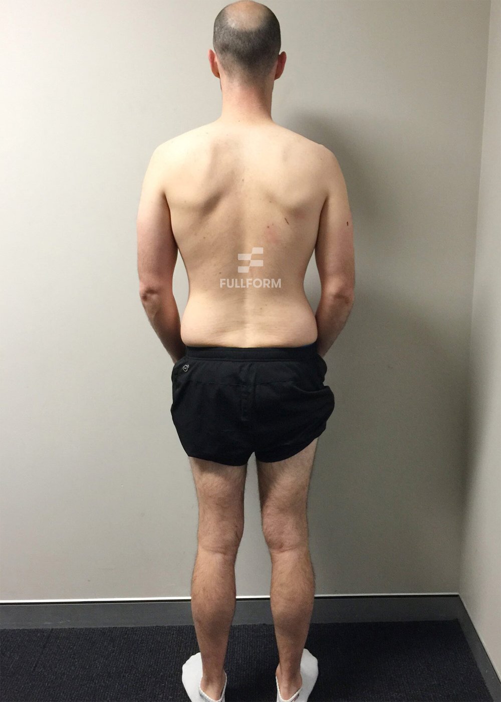 FullForm client before transformation