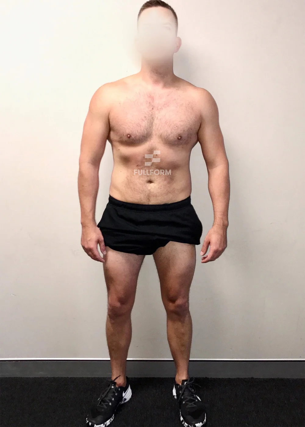 John after FullForm transformation in Sydney
