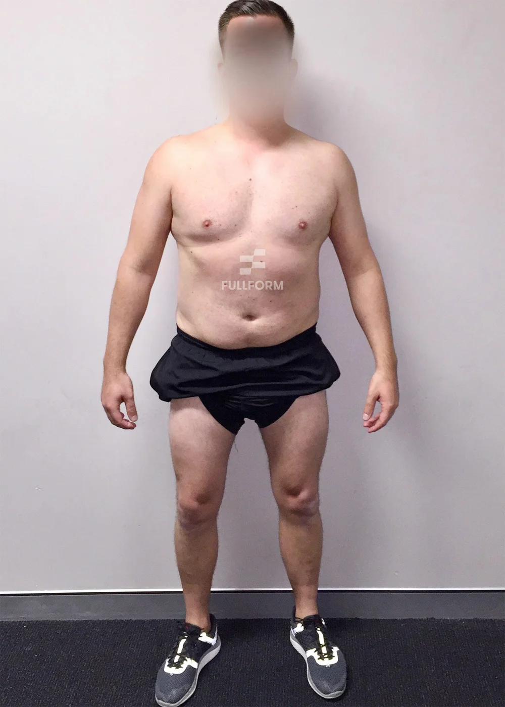 John before FullForm transformation in Sydney