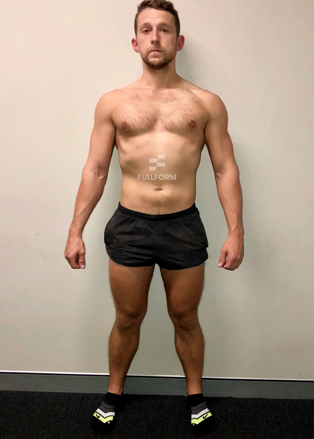 Nial after FullForm transformation in Sydney