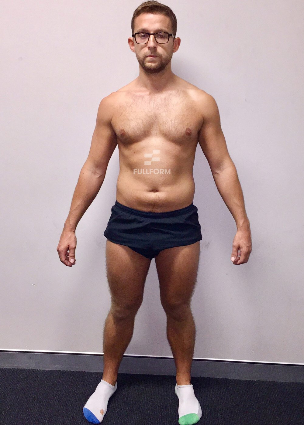 Nial before FullForm transformation in Sydney