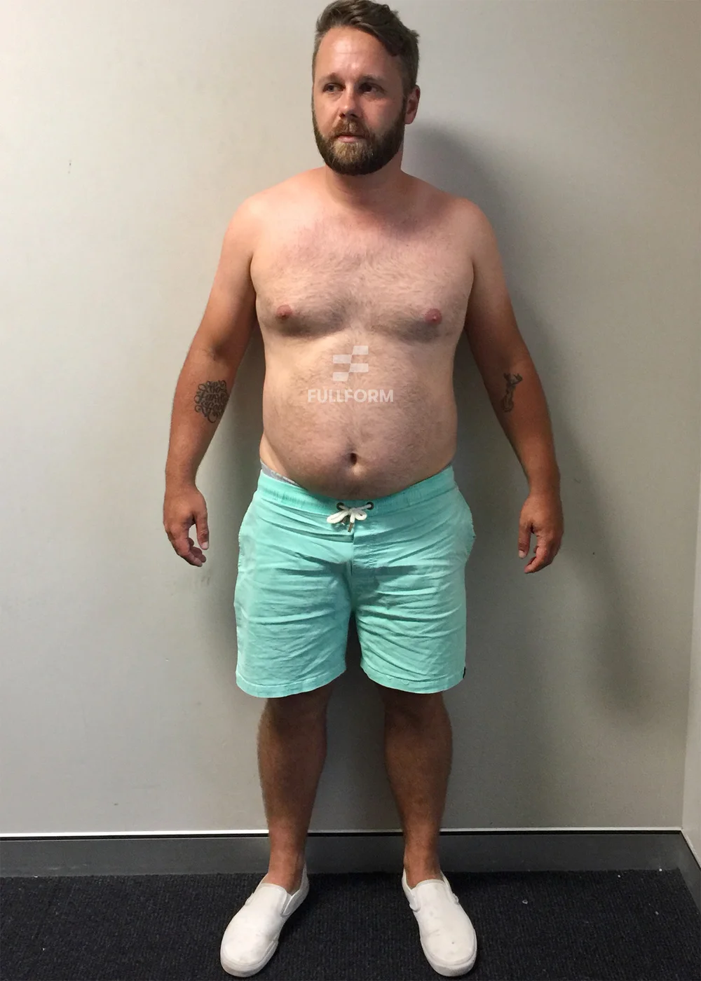 Cameron before FullForm transformation in Sydney