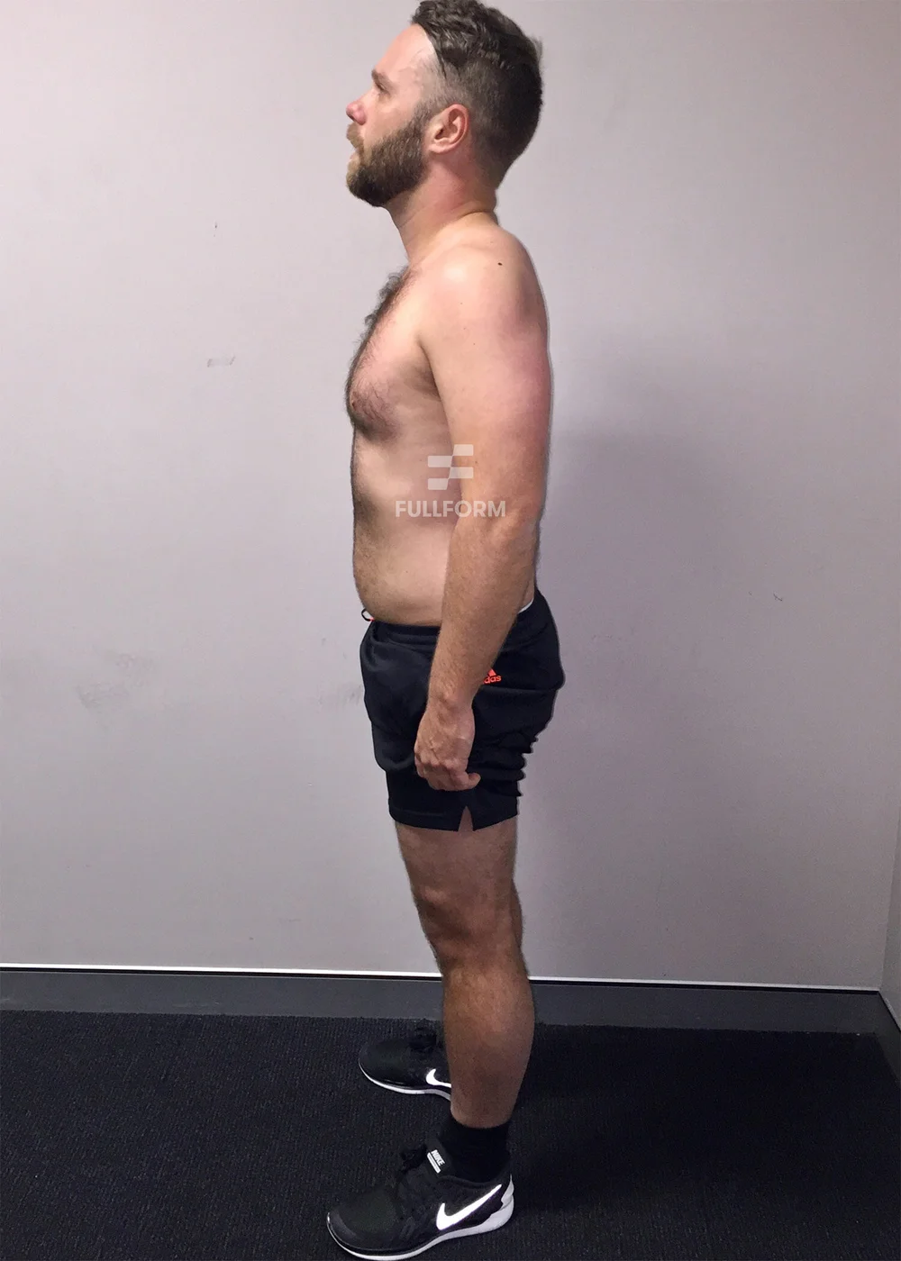 FullForm client after transformation