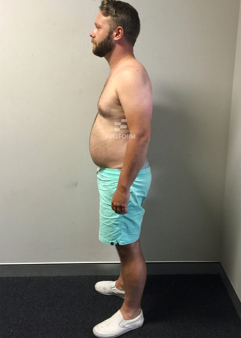 FullForm client before transformation