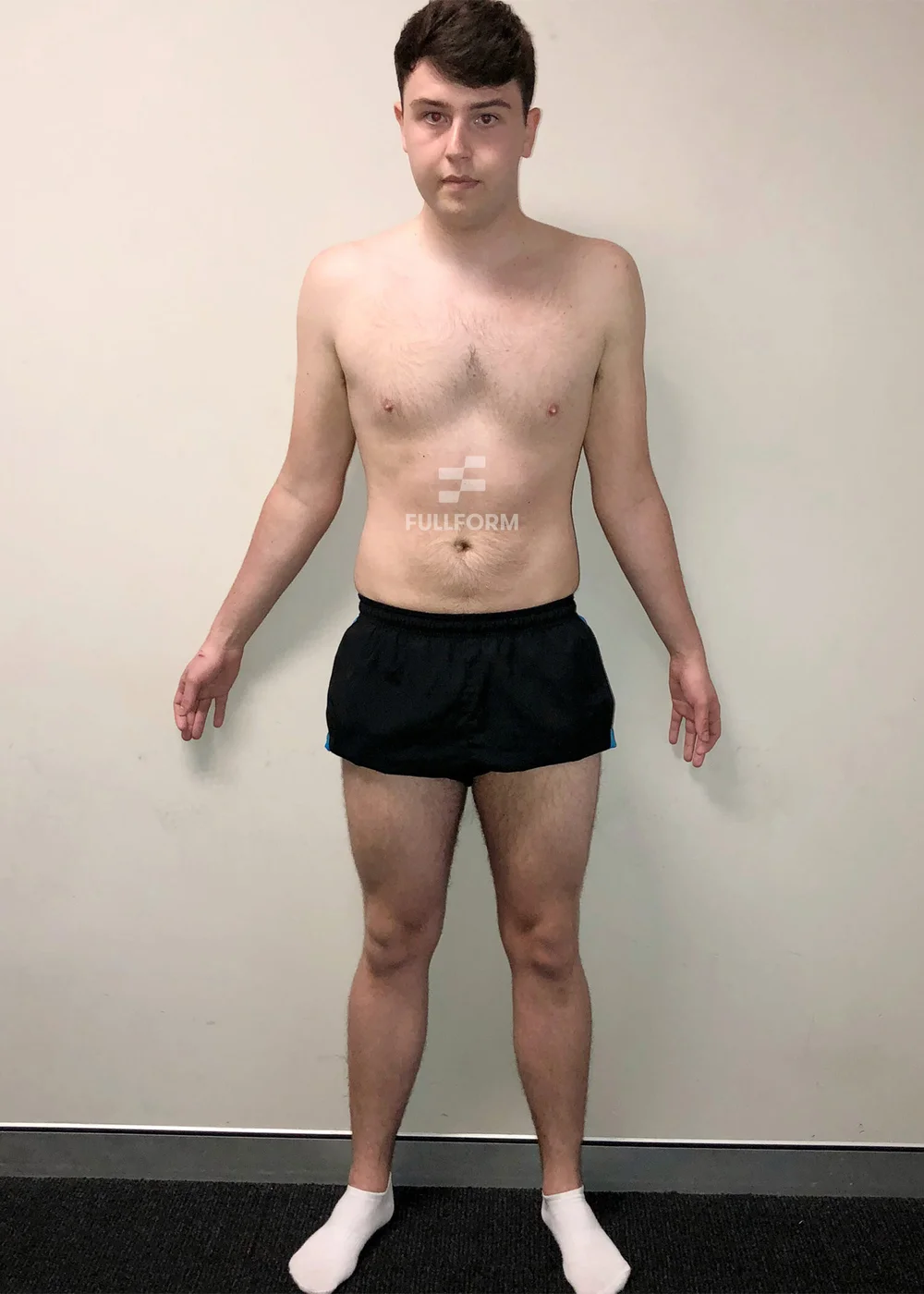 Jason before FullForm transformation in Sydney