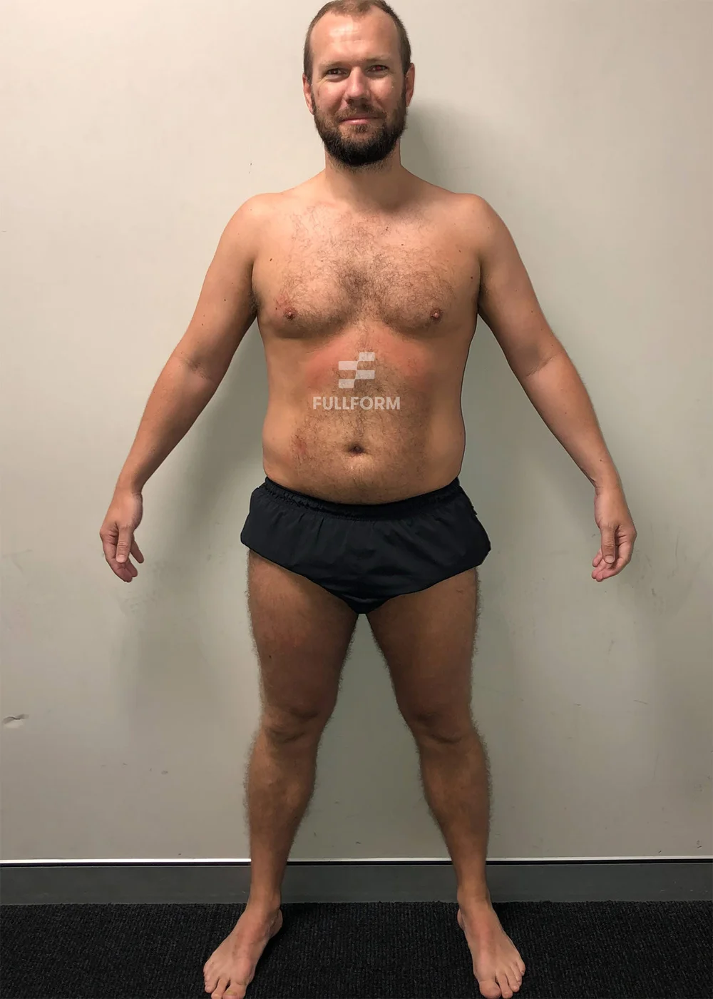 Scott before FullForm transformation in Sydney