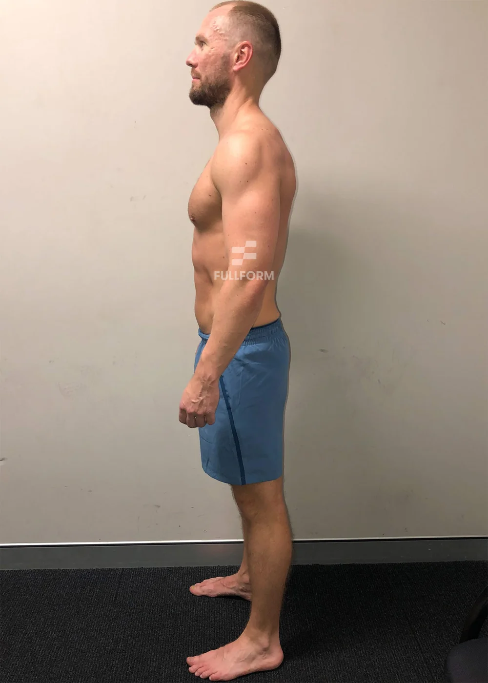 FullForm client after transformation