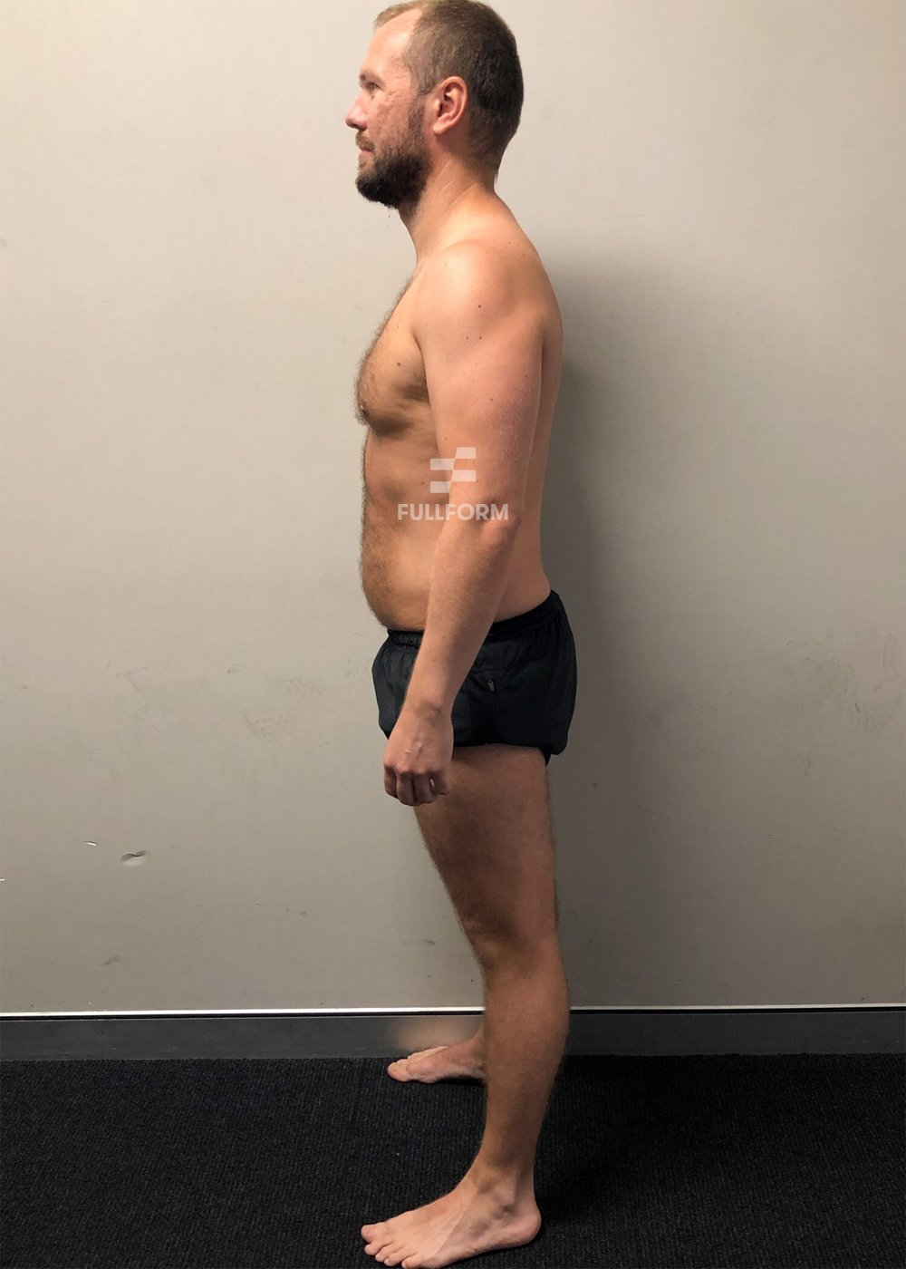 FullForm client before transformation