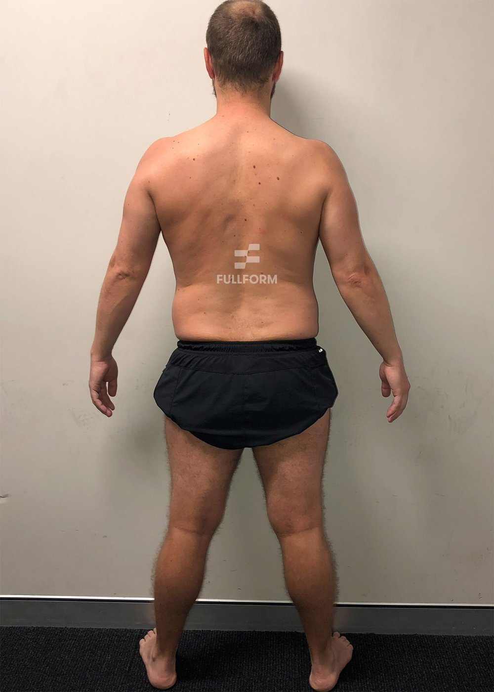 FullForm client before transformation