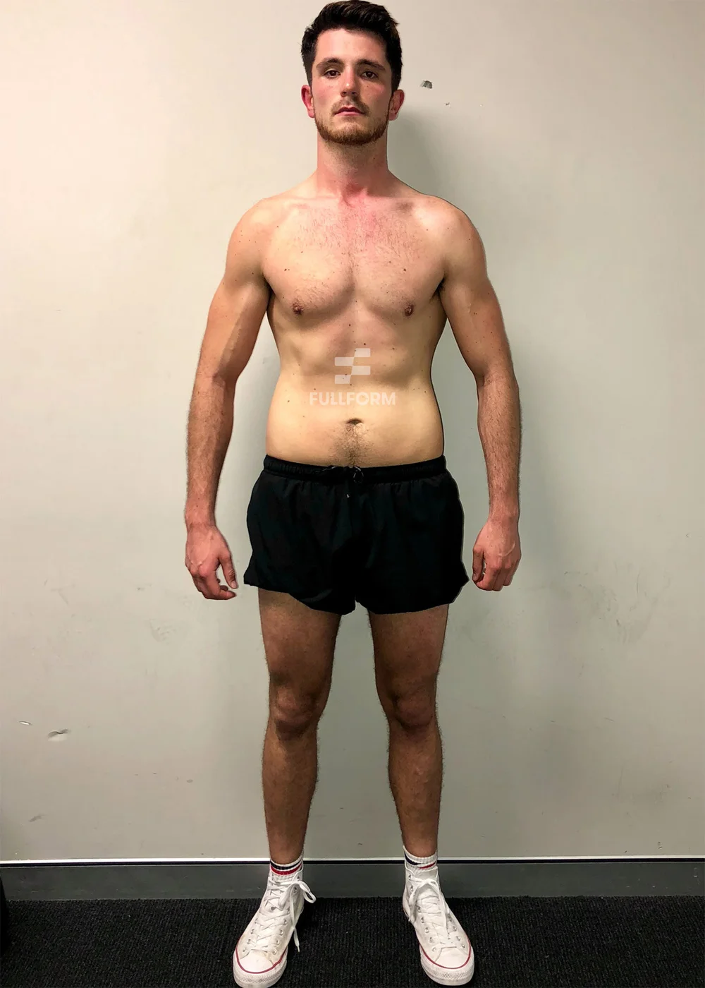 Willem after FullForm transformation in Sydney
