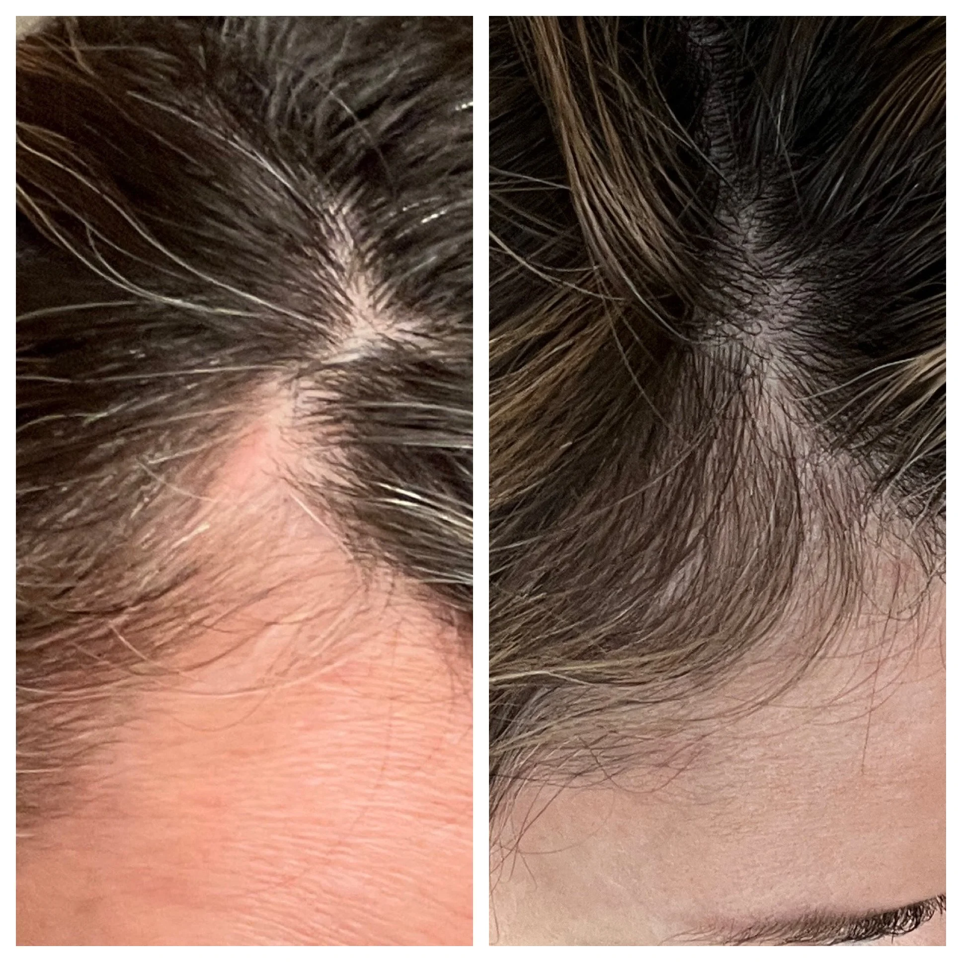 Megan Graham temple area before and after MONAT