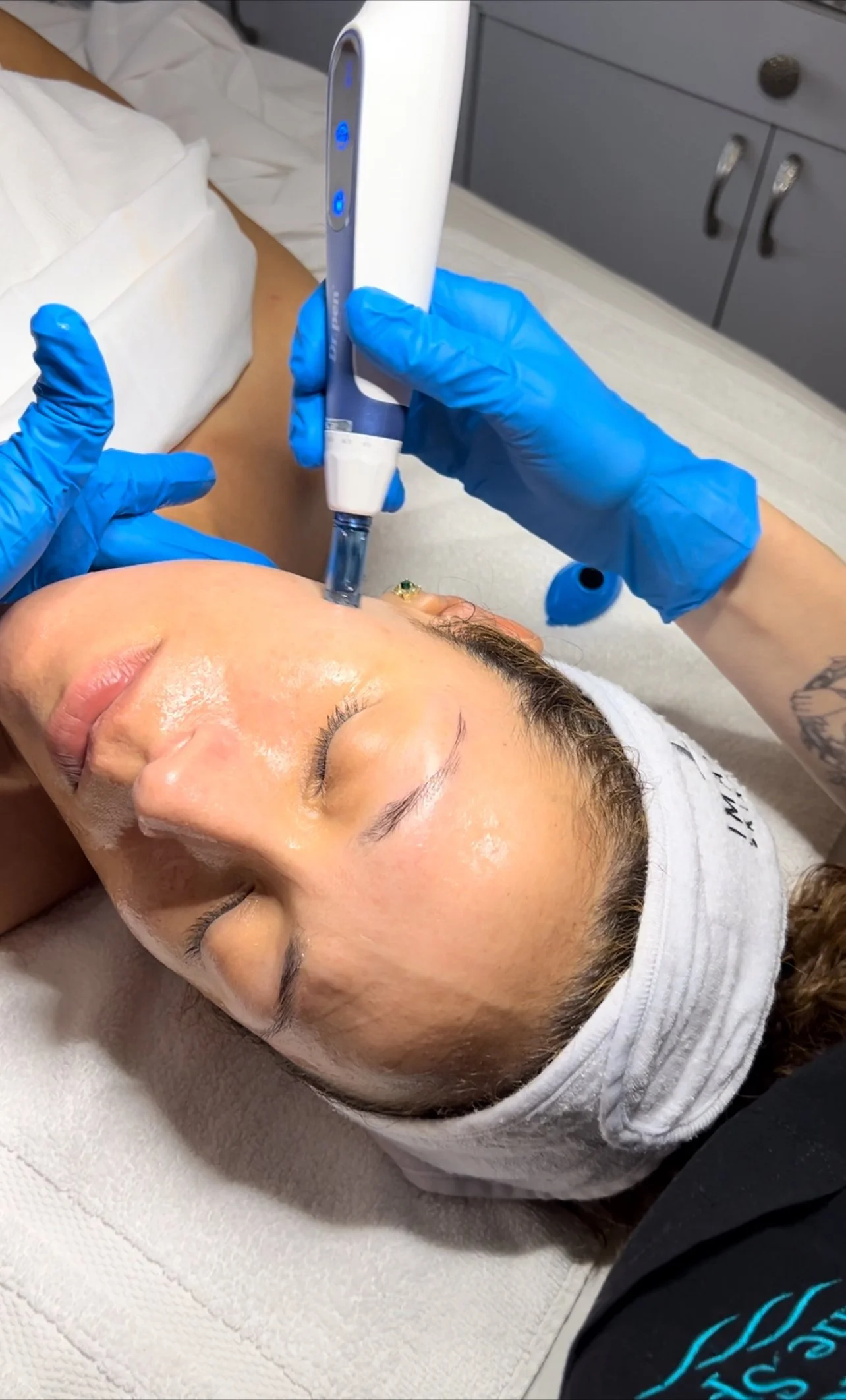 Microneedling at The Lane Spa in Palm Beach Gardens