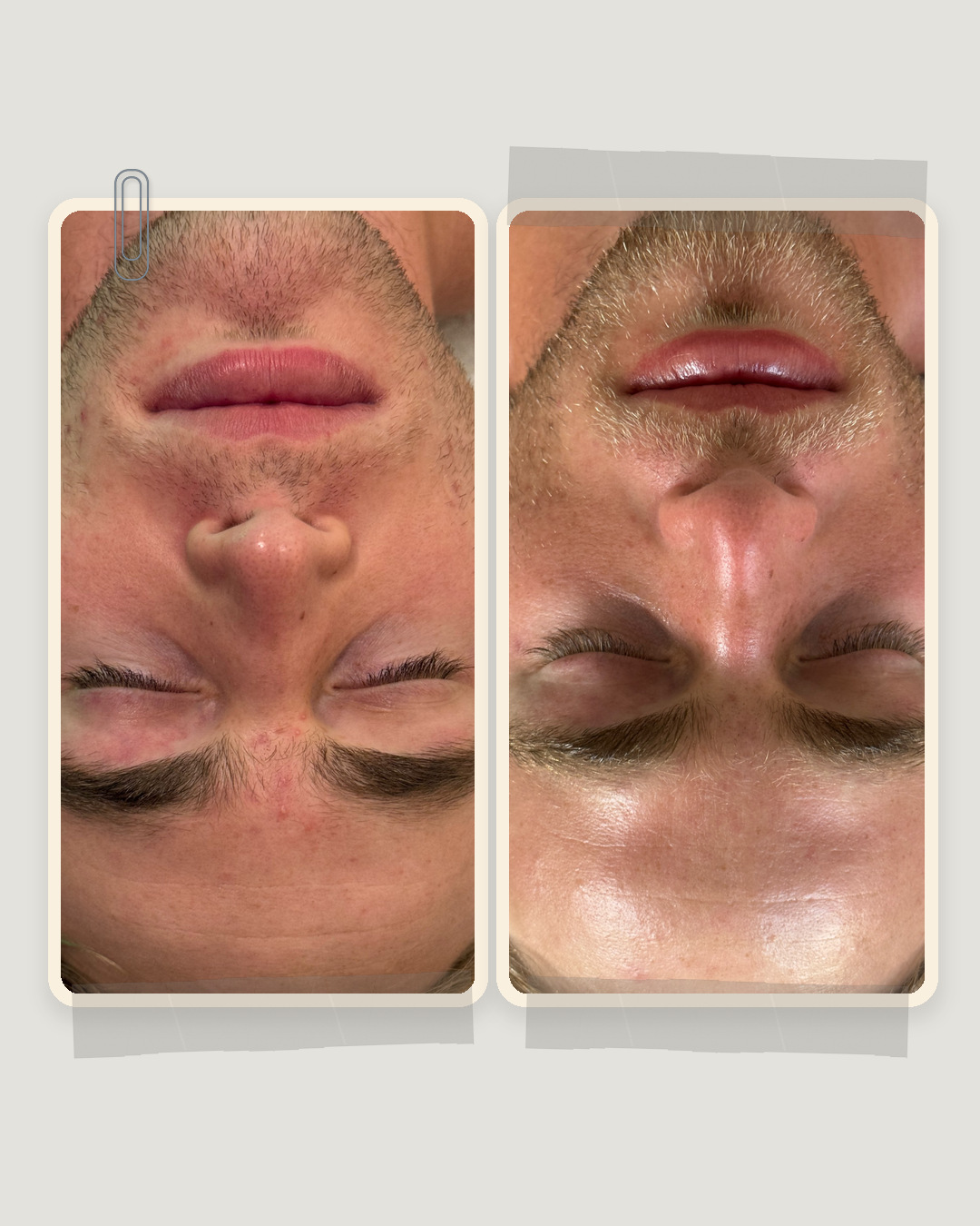 Skin Factory before and after