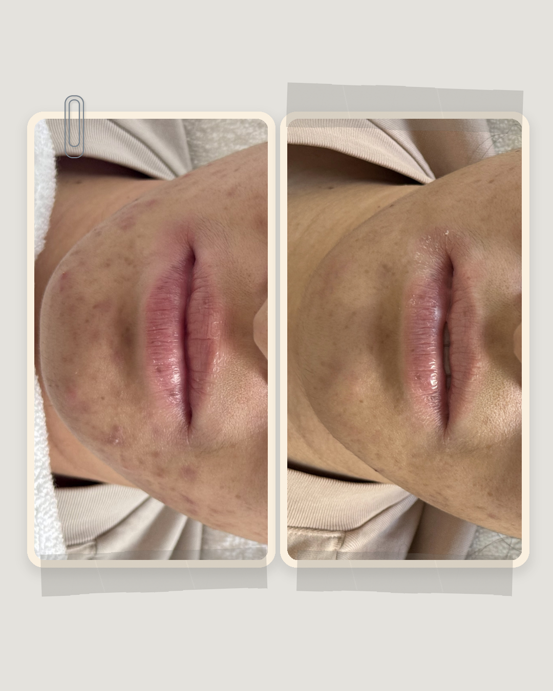Skin Factory before and after