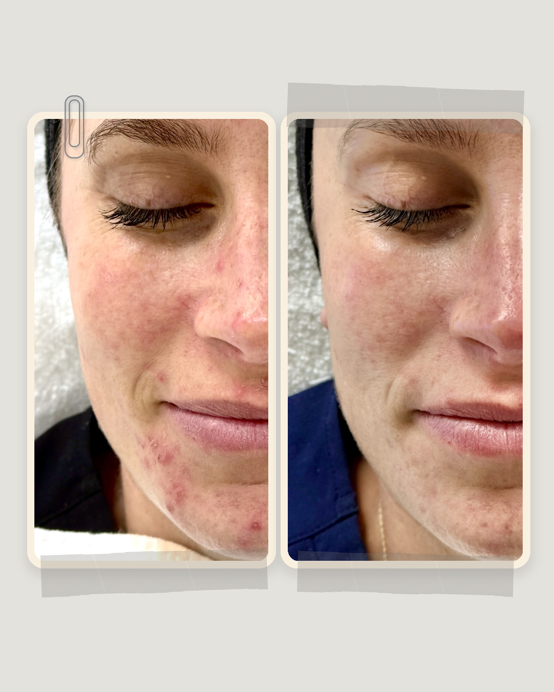 Skin Factory before and after
