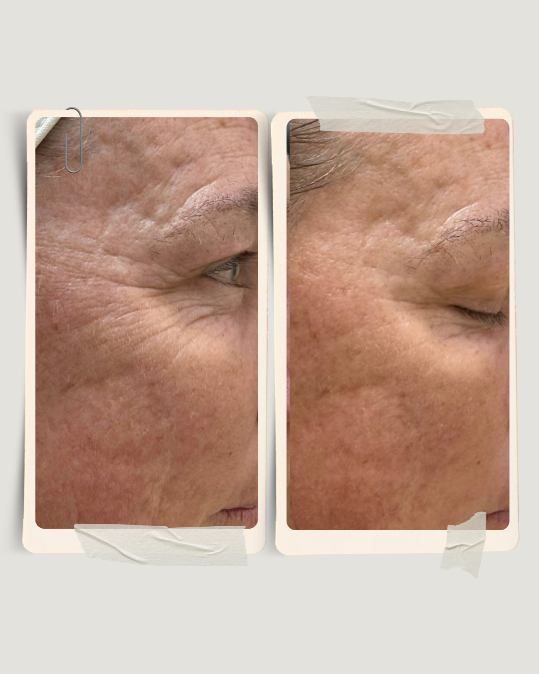 Skin Factory before and after