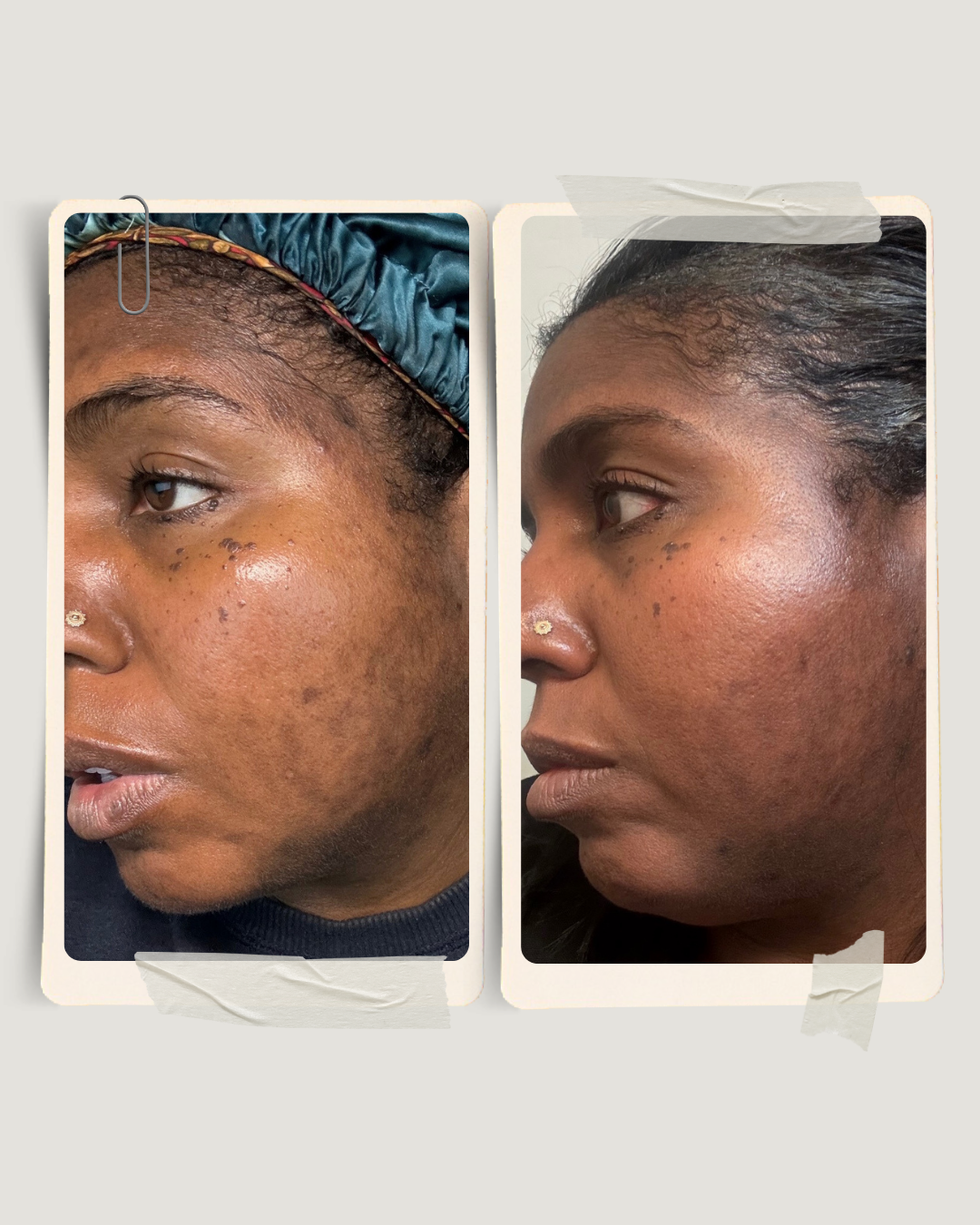Skin Factory before and after