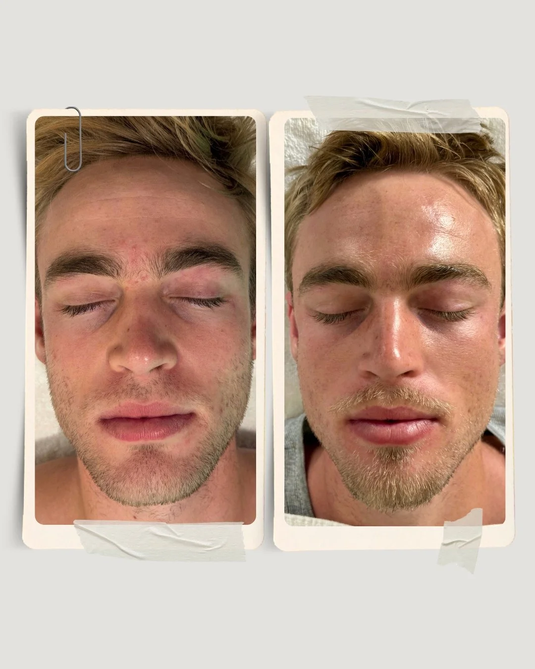 Skin Factory before and after