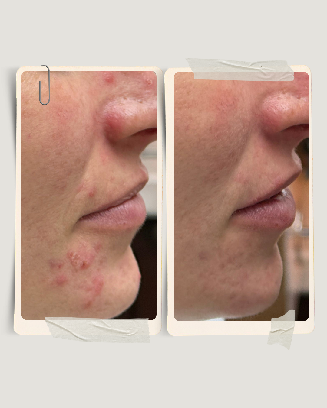 Skin Factory before and after