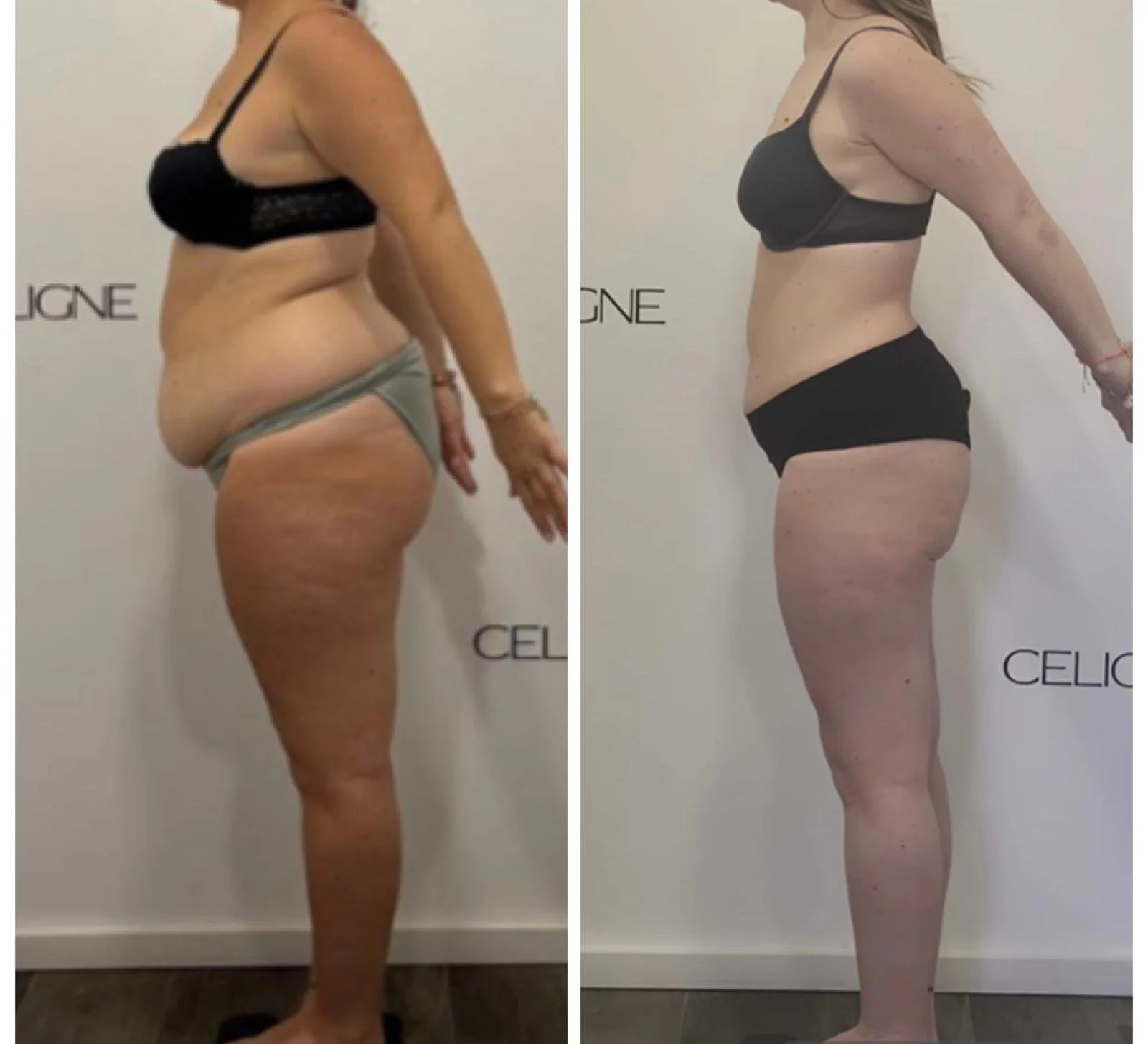 Transformation silhouette Celigne Terville