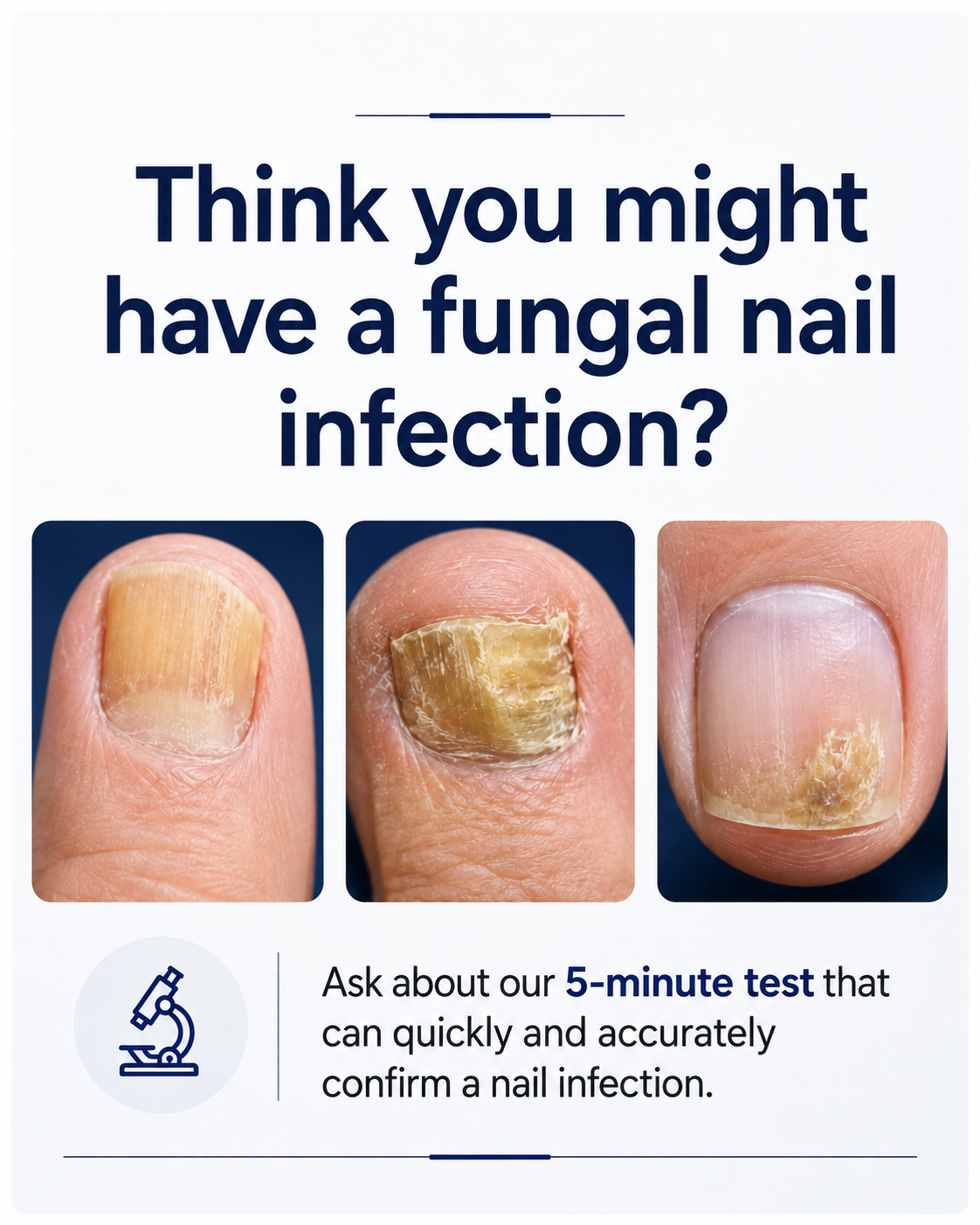 The Podiatry Clinic 5-minute fungal nail test information poster