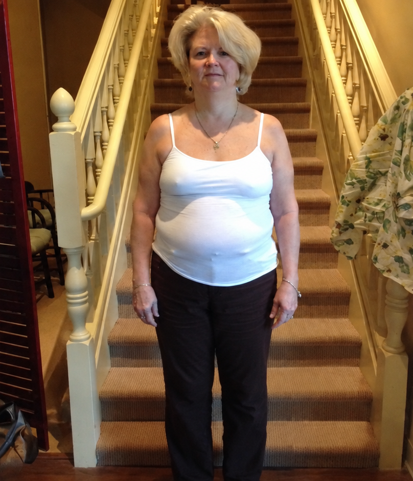 Jolene before her wellness journey