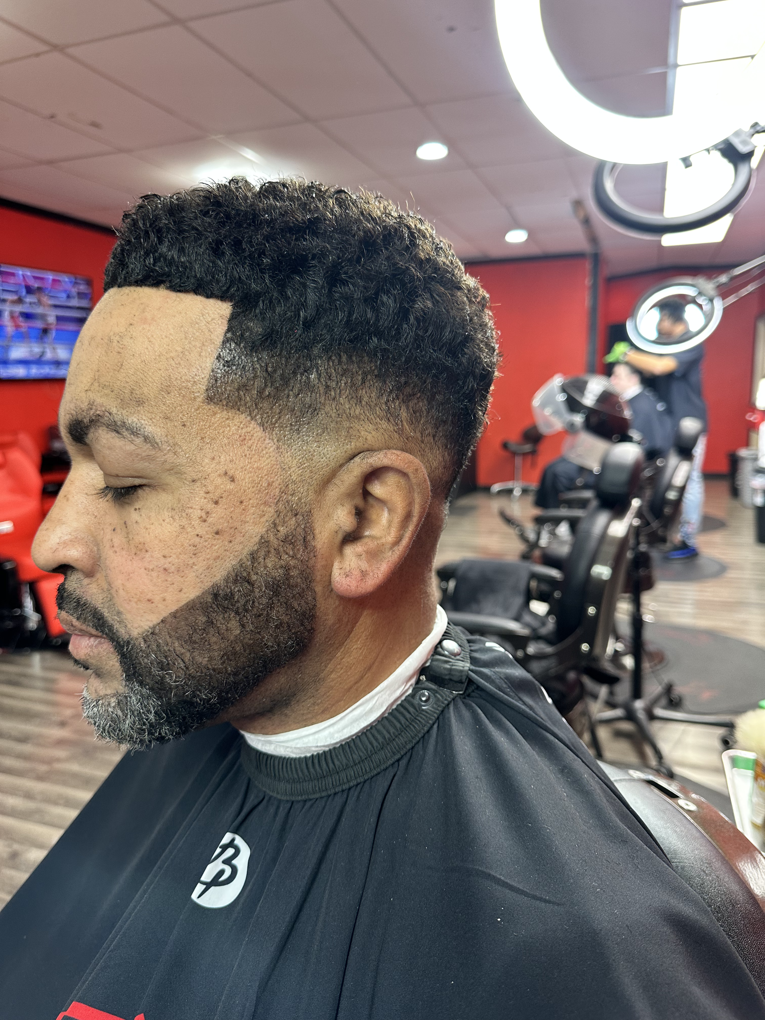 After Hair Restoration