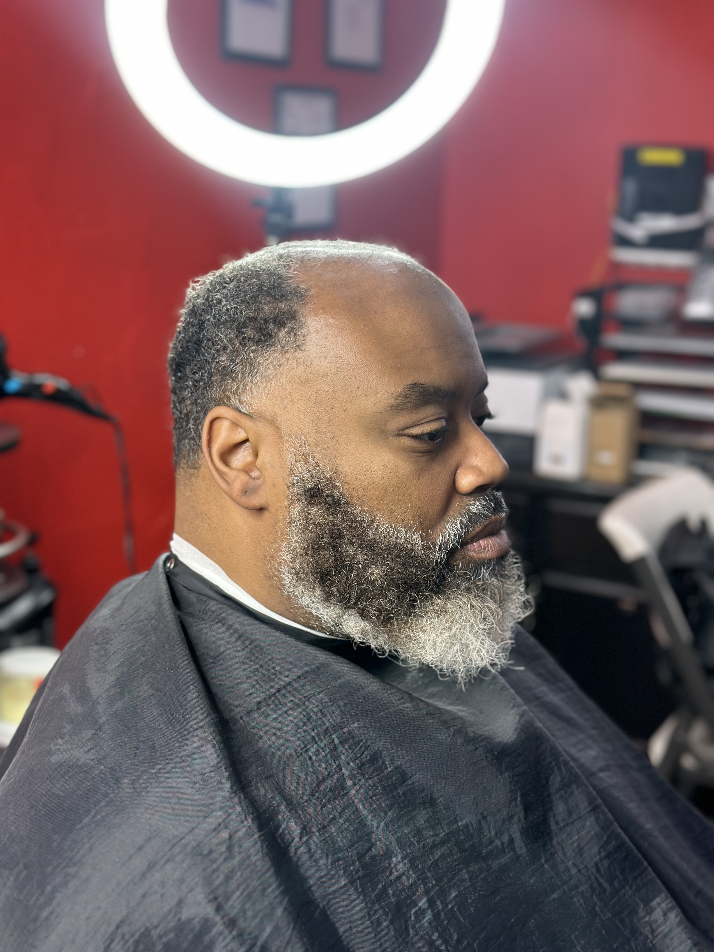 Before Hair Restoration