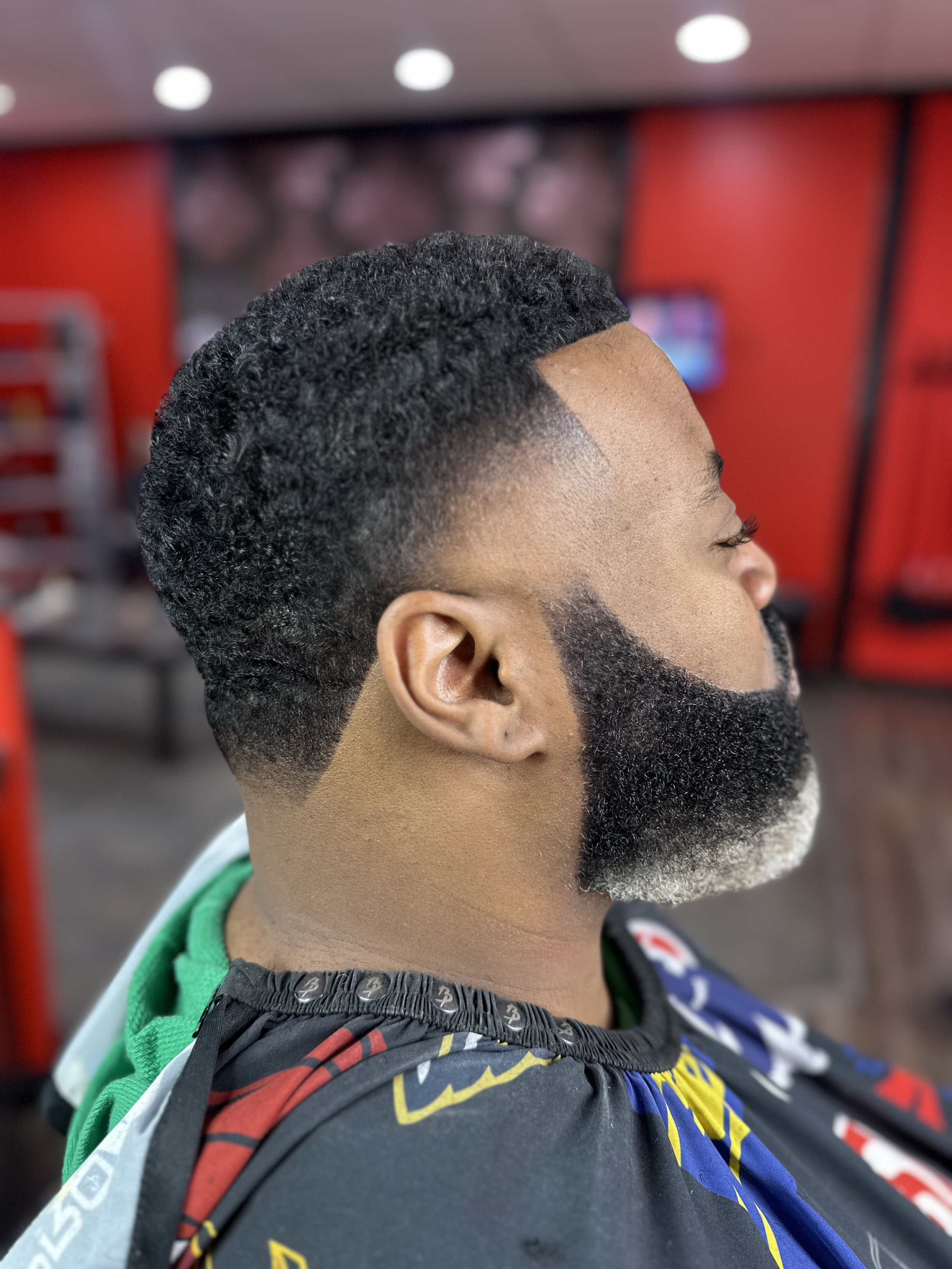 After Hair Restoration