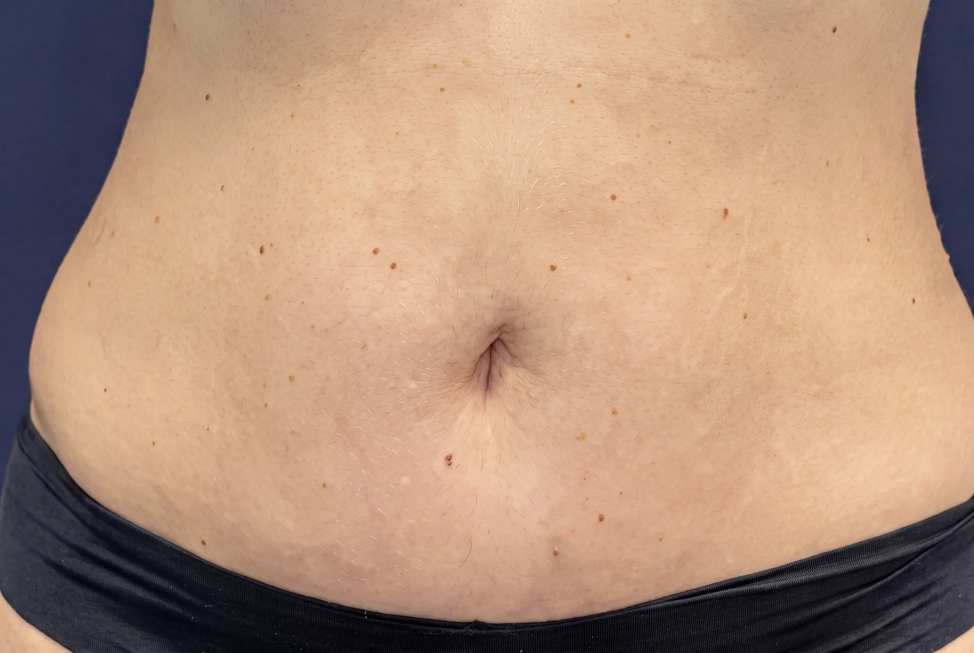 After treatment